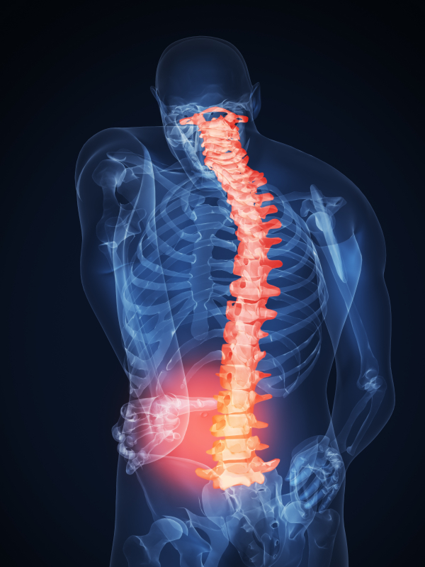 Arthritis Pain in Lower Back