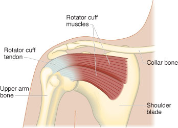 Shoulder Pain - Rotator Cuff